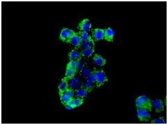 Immunocytochemistry/ Immunofluorescence - Anti-AK3L1 antibody [EPR7678] (AB131327)