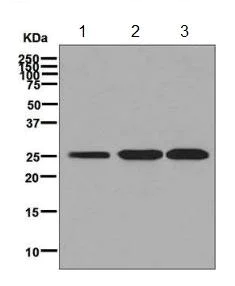 Western blot - Anti-AK3L1 antibody [EPR7678] (AB131327)