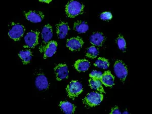 Immunocytochemistry/ Immunofluorescence - Anti-AK3L1 antibody [EPR7679] (AB156880)