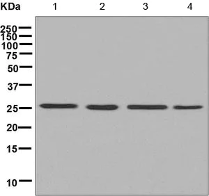 Western blot - Anti-AK3L1 antibody [EPR7679] (AB156880)