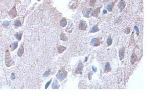 Immunohistochemistry (Formalin/PFA-fixed paraffin-embedded sections) - Anti-AK5 antibody (AB85132)
