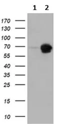 Western blot - Anti-AK5 antibody [OTI1D6] (AB117927)