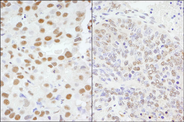 Immunohistochemistry (Formalin/PFA-fixed paraffin-embedded sections) - Anti-AKAP 95 antibody (AB72196)