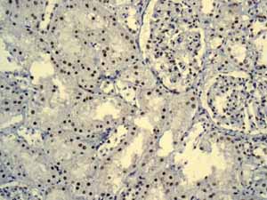 Immunohistochemistry (Formalin/PFA-fixed paraffin-embedded sections) - Anti-AKAP 95 antibody [EPR8978(B)] (AB134923), expandable thumbnail