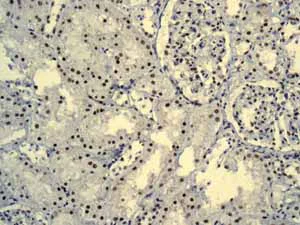 Immunohistochemistry (Formalin/PFA-fixed paraffin-embedded sections) - Anti-AKAP 95 antibody [EPR8978(B)] (AB134923)