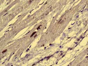 Immunohistochemistry (Formalin/PFA-fixed paraffin-embedded sections) - Anti-AKAP 95 antibody [EPR8978(B)] (ab134923), expandable thumbnail