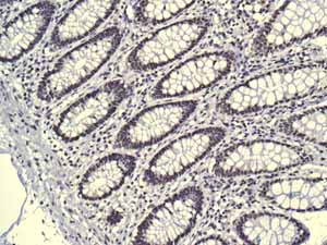 Immunohistochemistry (Formalin/PFA-fixed paraffin-embedded sections) - Anti-AKAP 95 antibody [EPR8978(B)] (ab134923), expandable thumbnail
