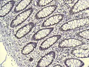 Immunohistochemistry (Formalin/PFA-fixed paraffin-embedded sections) - Anti-AKAP 95 antibody [EPR8978(B)] (AB134923)