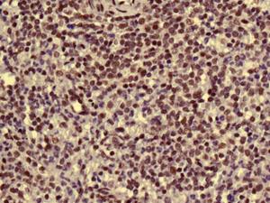 Immunohistochemistry (Formalin/PFA-fixed paraffin-embedded sections) - Anti-AKAP 95 antibody [EPR8978(B)] (AB134923), expandable thumbnail
