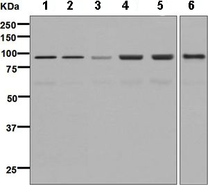 Western blot - Anti-AKAP 95 antibody [EPR8978(B)] (AB134923), expandable thumbnail