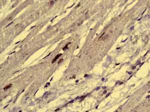 Immunohistochemistry (Formalin/PFA-fixed paraffin-embedded sections) - Anti-AKAP 95 antibody [EPR8978(B)] - BSA and Azide free (AB248732)