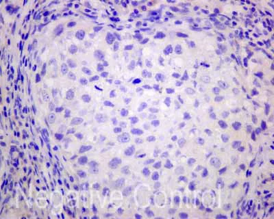 Immunohistochemistry (Formalin/PFA-fixed paraffin-embedded sections) - Anti-AKAP associated Sperm Protein/ROPN1L antibody [EPR11266(B)] (AB173298)