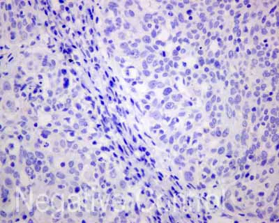 Immunohistochemistry (Formalin/PFA-fixed paraffin-embedded sections) - Anti-AKAP associated Sperm Protein/ROPN1L antibody [EPR11266(B)] (AB173298)