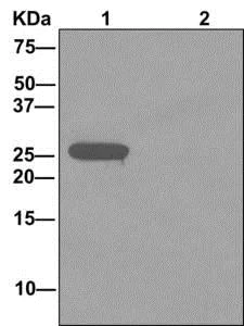 Immunoprecipitation - Anti-AKAP associated Sperm Protein/ROPN1L antibody [EPR11266(B)] (AB173298)