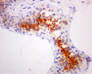 Immunohistochemistry (Formalin/PFA-fixed paraffin-embedded sections) - Anti-AKAP associated Sperm Protein/ROPN1L antibody [EPR11266(B)] - BSA and Azide free (AB249759)