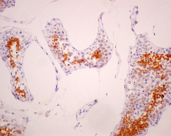 Immunohistochemistry (Formalin/PFA-fixed paraffin-embedded sections) - Anti-AKAP associated Sperm Protein/ROPN1L antibody [EPR11266(B)] - BSA and Azide free (AB249759)