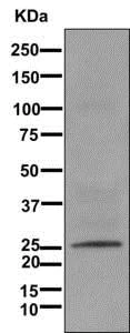 Western blot - Anti-AKAP associated Sperm Protein/ROPN1L antibody [EPR11266(B)] - BSA and Azide free (AB249759)
