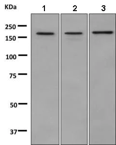 Western blot - Anti-AKAP1 antibody [EPR10518] (AB156004)