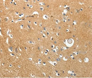 Immunohistochemistry (Formalin/PFA-fixed paraffin-embedded sections) - Anti-AKAP12 antibody - C-terminal (AB198895)