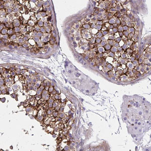 Immunohistochemistry (Formalin/PFA-fixed paraffin-embedded sections) - Anti-AKAP12 antibody - C-terminal (AB204559)