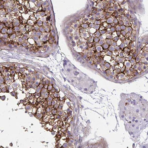 Immunohistochemistry (Formalin/PFA-fixed paraffin-embedded sections) - Anti-AKAP12 antibody - C-terminal (AB204559)