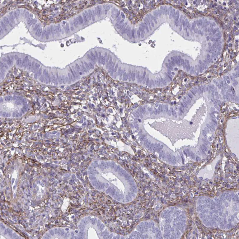 Immunohistochemistry (Formalin/PFA-fixed paraffin-embedded sections) - Anti-AKAP12 antibody - C-terminal (AB204559)