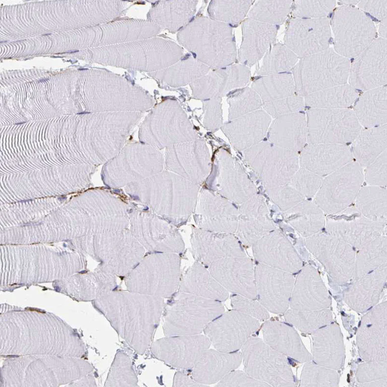 Immunohistochemistry (Formalin/PFA-fixed paraffin-embedded sections) - Anti-AKAP12 antibody - C-terminal (AB204559)
