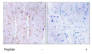 Immunohistochemistry (Formalin/PFA-fixed paraffin-embedded sections) - Anti-AKAP13/p47 antibody (AB74048)