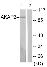 Western blot - Anti-AKAP2 antibody (AB64904), expandable thumbnail