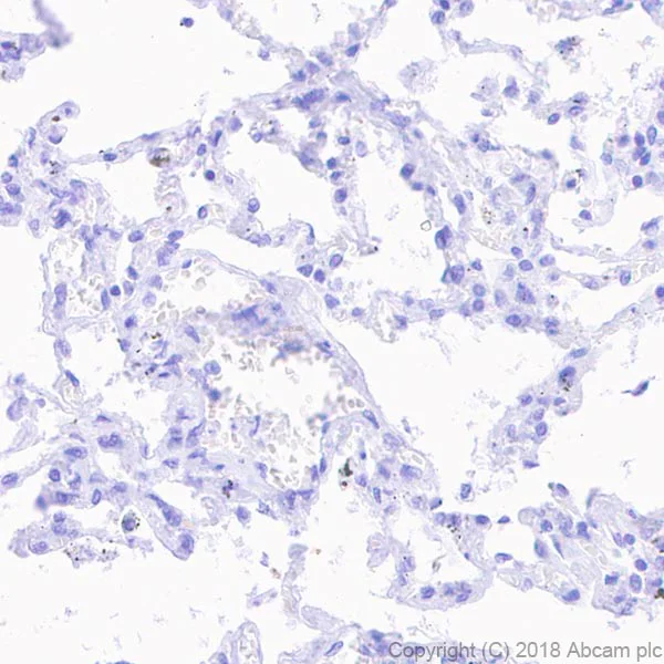 Immunohistochemistry (Formalin/PFA-fixed paraffin-embedded sections) - Anti-AKAP4 antibody [EPR21123] (AB230954)