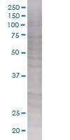 SDS-PAGE - AKIP overexpression 293T lysate (whole cell) (AB94297)