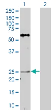 Western blot - AKIP overexpression 293T lysate (whole cell) (AB94297)
