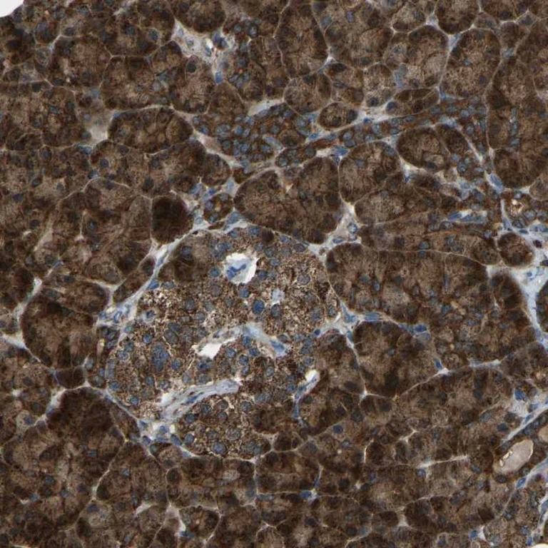 Immunohistochemistry (Formalin/PFA-fixed paraffin-embedded sections) - Anti-AKR1A1 antibody (AB251727)