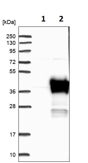 Western blot - Anti-AKR1A1 antibody (AB251727)