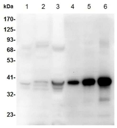 Western blot - Anti-AKR1B10 antibody (AB273011)