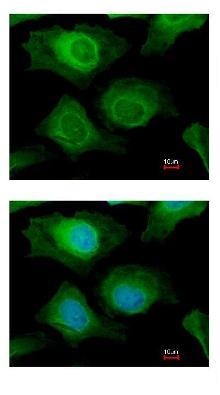 Immunocytochemistry/ Immunofluorescence - Anti-AKR1B10 antibody (AB96417)