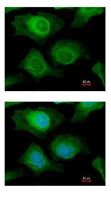 Immunocytochemistry/ Immunofluorescence - Anti-AKR1B10 antibody (AB96417)