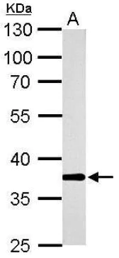 Western blot - Anti-AKR1B10 antibody (AB96417)