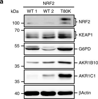 Western blot - Anti-AKR1B10 antibody (AB96417)