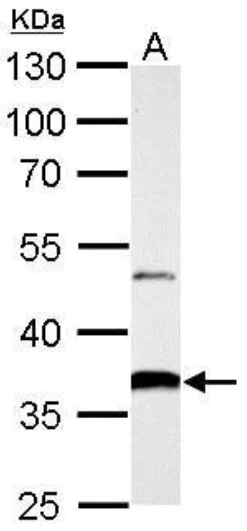 Western blot - Anti-AKR1B10 antibody (AB96417)