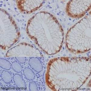 Immunohistochemistry (Formalin/PFA-fixed paraffin-embedded sections) - Anti-AKR1B10 antibody [EPR14421] (AB192865)