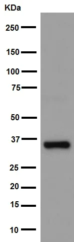 Western blot - Anti-AKR1B10 antibody [EPR14421] (AB192865)