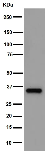 Western blot - Anti-AKR1B10 antibody [EPR14421] (AB192865)