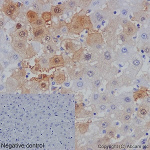 Immunohistochemistry (Formalin/PFA-fixed paraffin-embedded sections) - Anti-AKR1B10 antibody [EPR14421] - BSA and Azide free (AB232623), expandable thumbnail