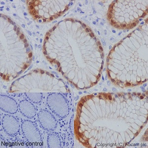 Immunohistochemistry (Formalin/PFA-fixed paraffin-embedded sections) - Anti-AKR1B10 antibody [EPR14421] - BSA and Azide free (AB232623), expandable thumbnail
