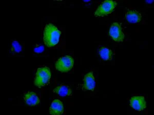 Immunocytochemistry/ Immunofluorescence - Anti-AKR1B10 antibody [EPR9767(B)] - BSA and Azide free (AB248881)