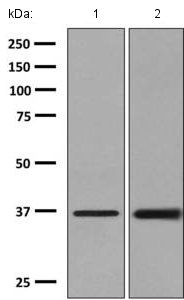 Western blot - Anti-AKR1B10 antibody [EPR9767(B)] - BSA and Azide free (AB248881), expandable thumbnail