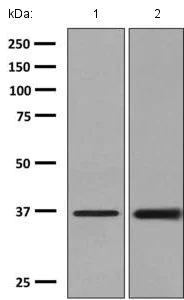 Western blot - Anti-AKR1B10 antibody [EPR9767(B)] - BSA and Azide free (AB248881)