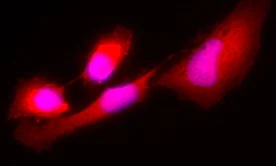 Immunocytochemistry/ Immunofluorescence - Anti-AKR1C1/AKR1C2 antibody [4B6AF3] (AB131375)