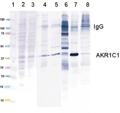 Western blot - Anti-AKR1C1/AKR1C2 antibody [4B6AF3] (AB131375), expandable thumbnail